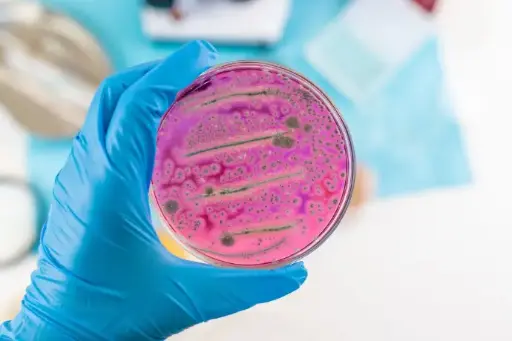 Antimicrobial Resistance (AMR)